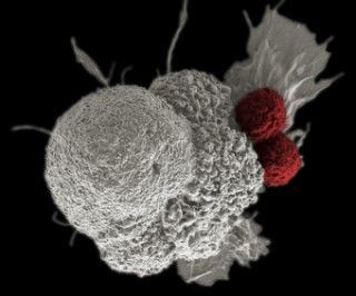 Two roughly spherical cells attached to a larger, irregularly shaped cell. Two roughly spherical cells attached to a larger, irregularly shaped cell.