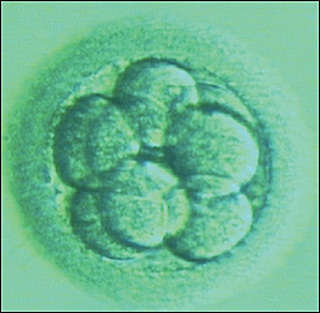 An eight-cell embryo viewed under a microscope, shown as a ball made up of eight circular shaped cells. An eight-cell embryo viewed under a microscope, shown as a ball made up of eight circular shaped cells.