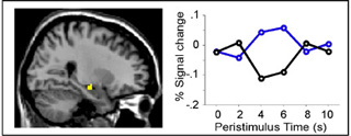 The hippocampus during conscious remembering of the past relative to memory based on stimulus familiarity. The hippocampus during conscious remembering of the past relative to memory based on stimulus familiarity.