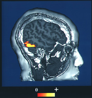 A computer-enhanced fMRI scan of a person looking at faces. The image indicates increased blood flow in the visual cortex. A computer-enhanced fMRI scan of a person looking at faces. The image indicates increased blood flow in the visual cortex.