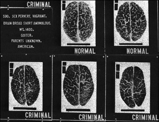 Set of photographs of brains labeled 'normal' and 'criminal'. Set of photographs of brains labeled 'normal' and 'criminal'.